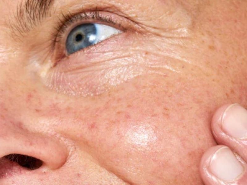 Softens the Look of Fine Lines