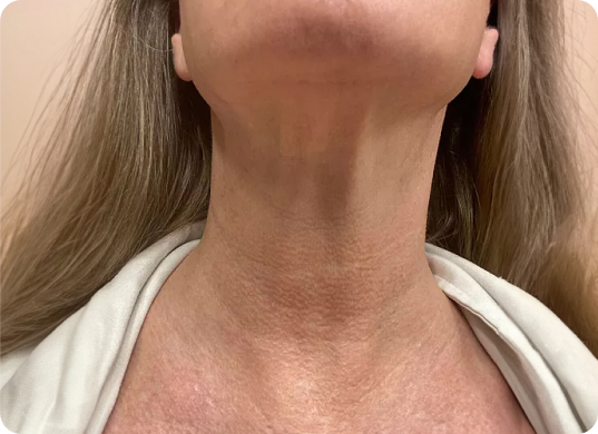 Hydrated-Looking Skin
