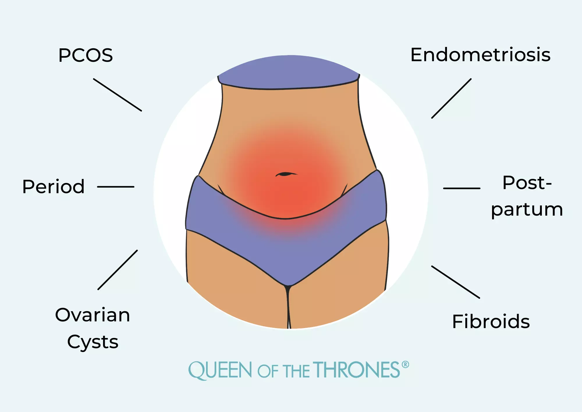 Queen of the Thrones® Castor Oil Pelvic Pack health solutions for Endometriosis and PCOS