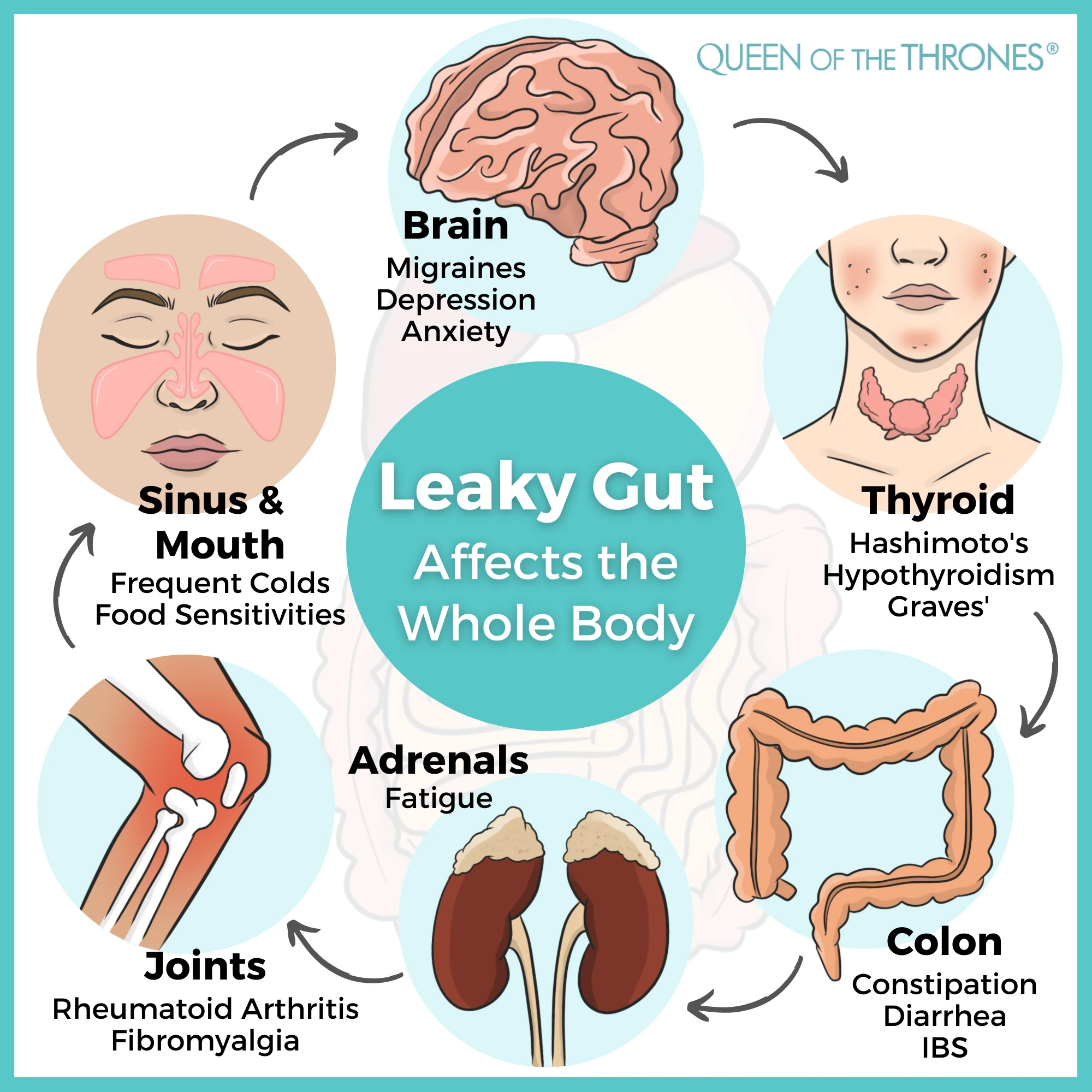Organs affected by Leaky Gut according to Queen of the Thrones