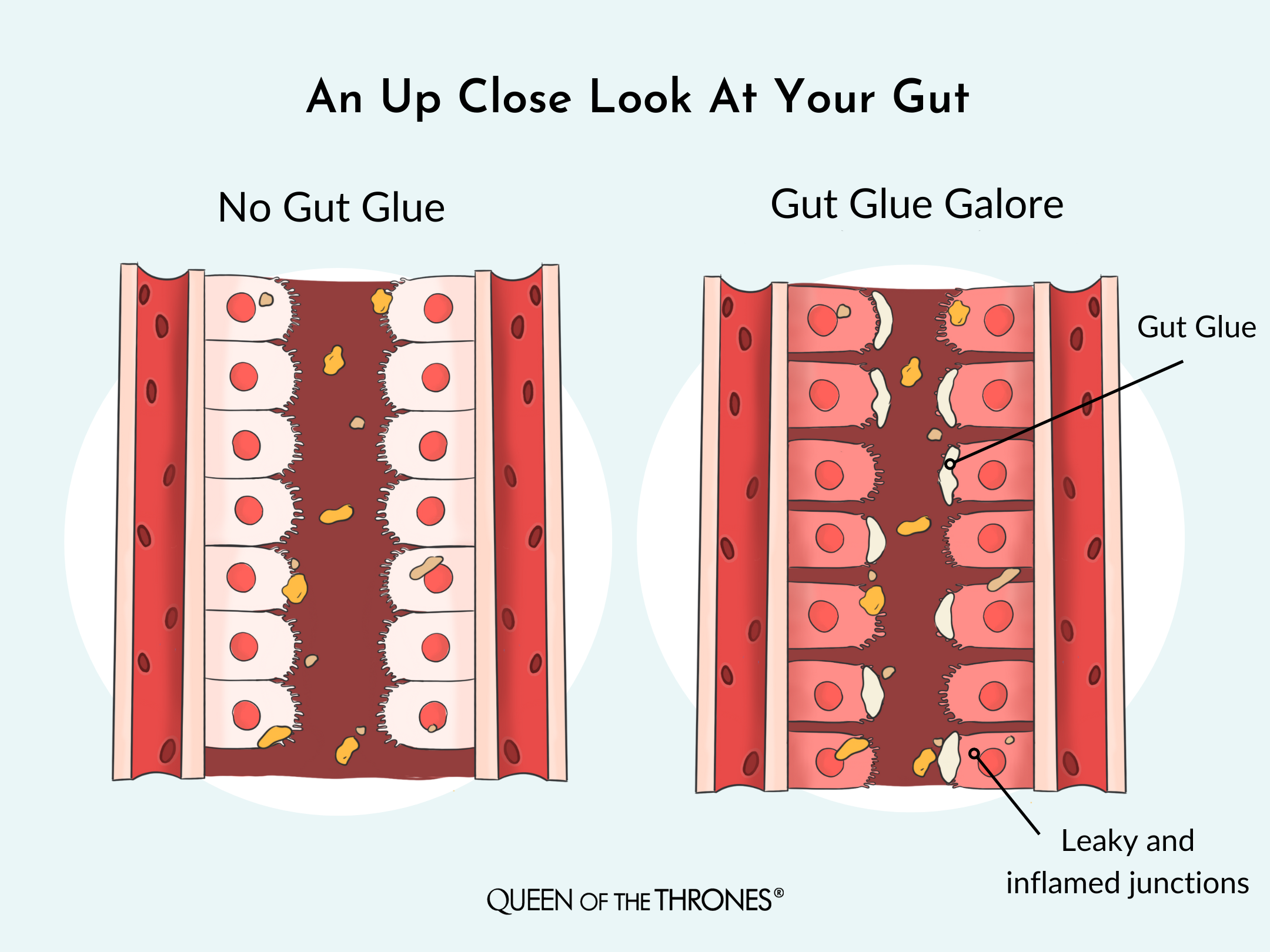 Gut glue junction by Queen of the Thrones
