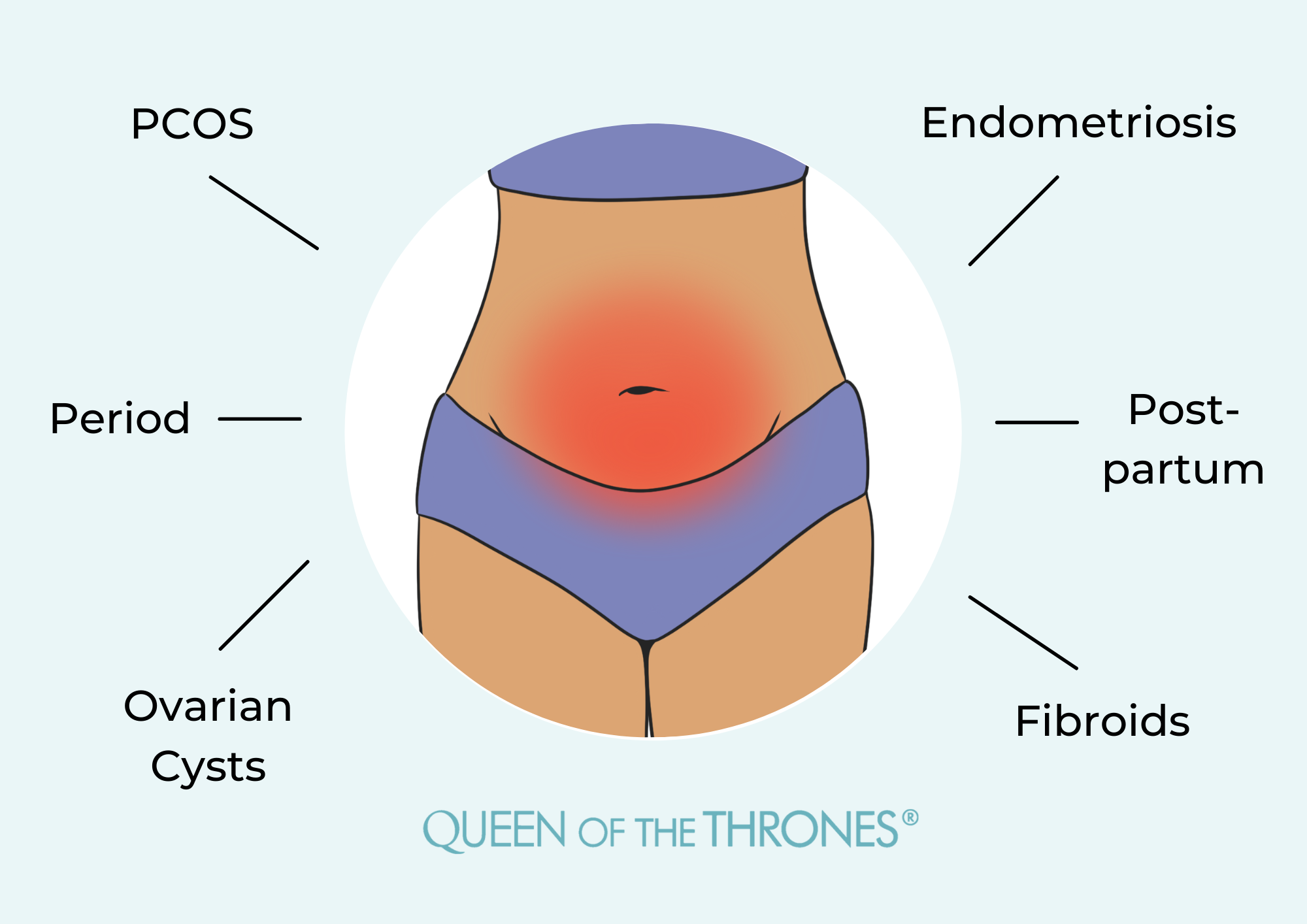 Queen of the Thrones Pelvic Region Illnesses