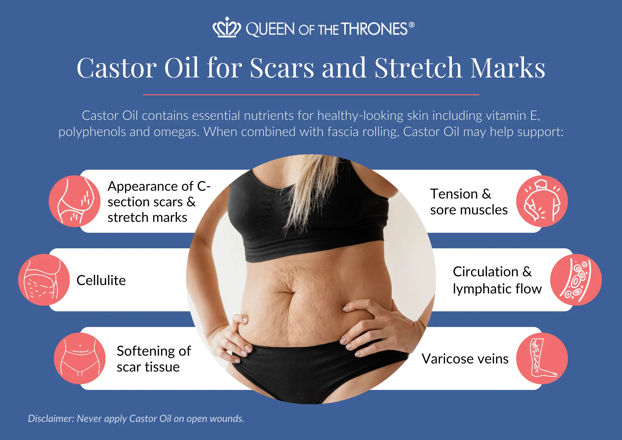 Queen of the Thrones Castor oil for scars and stretch marks