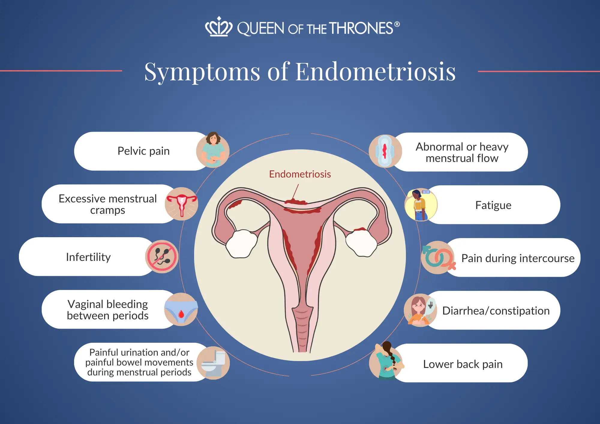 Symptoms of Endometriosis by Queens of the Thrones