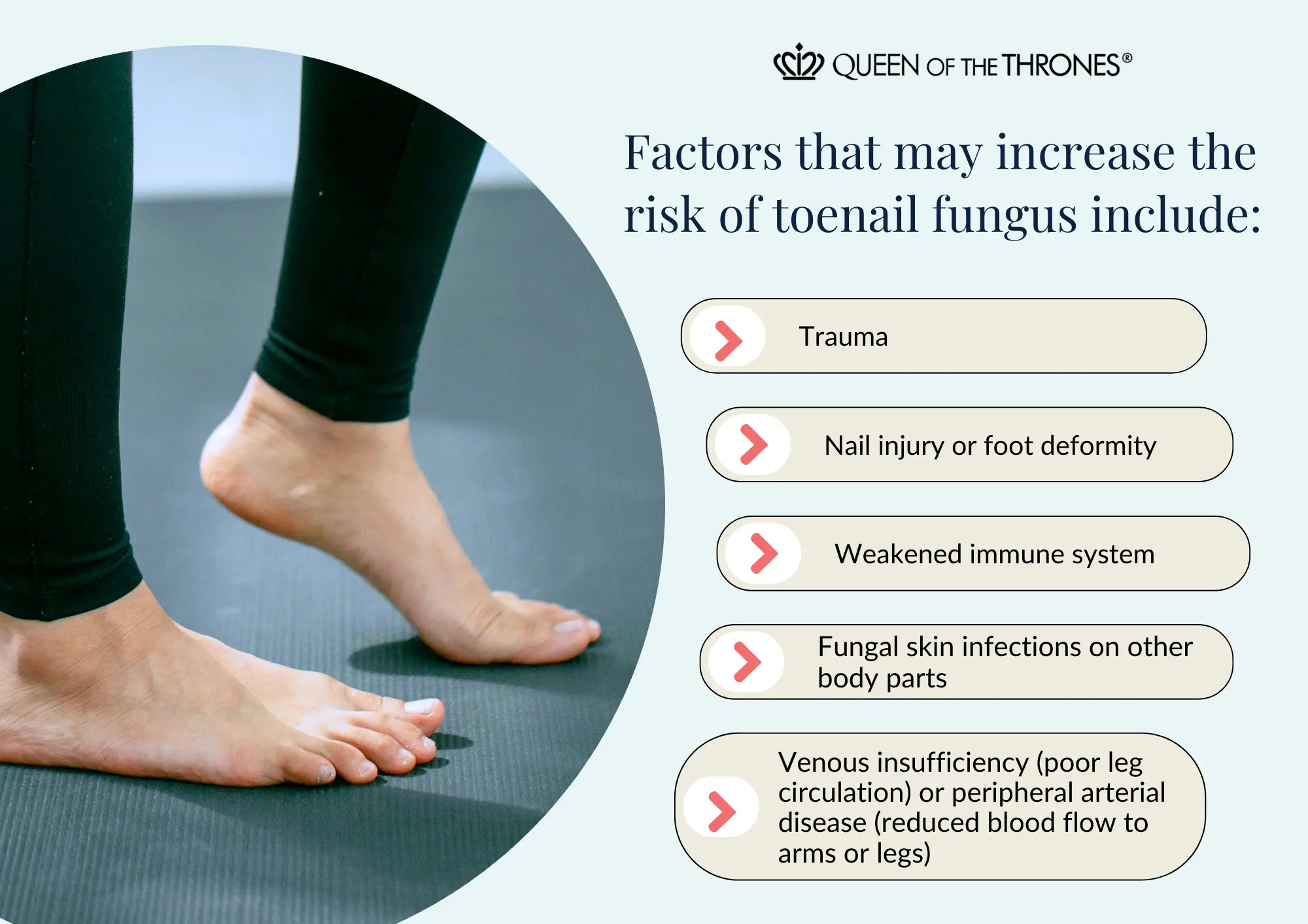 Factors that may increase risks of toe nail fungus by Queen of the Thrones