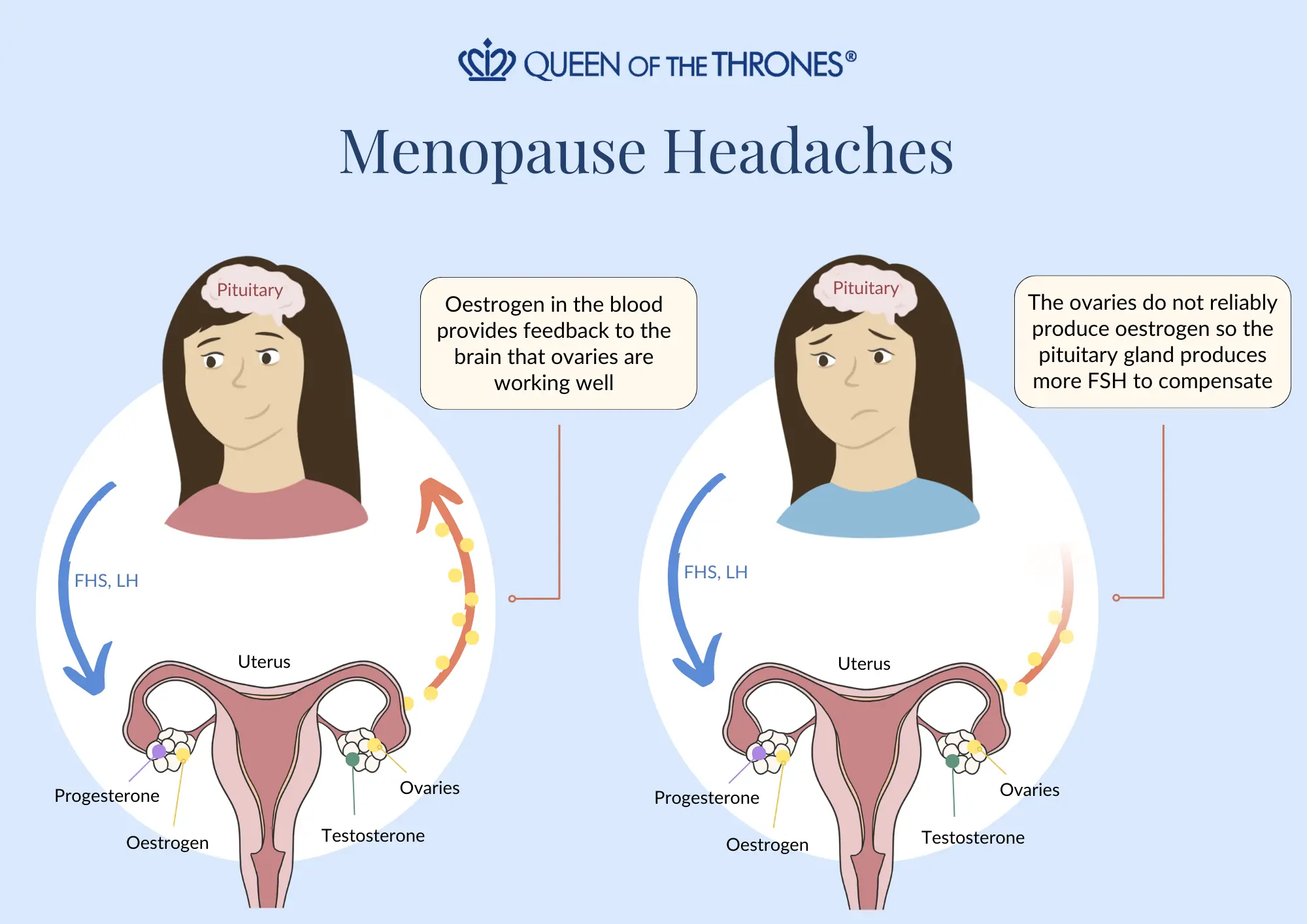 Menopause headaches by Queen of the Thrones 