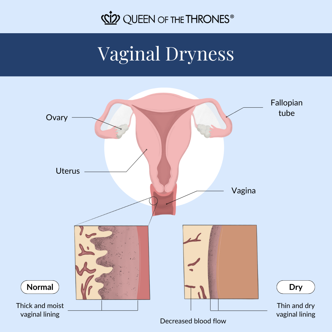 Vaginal dryness diagram by Queen of the Thrones